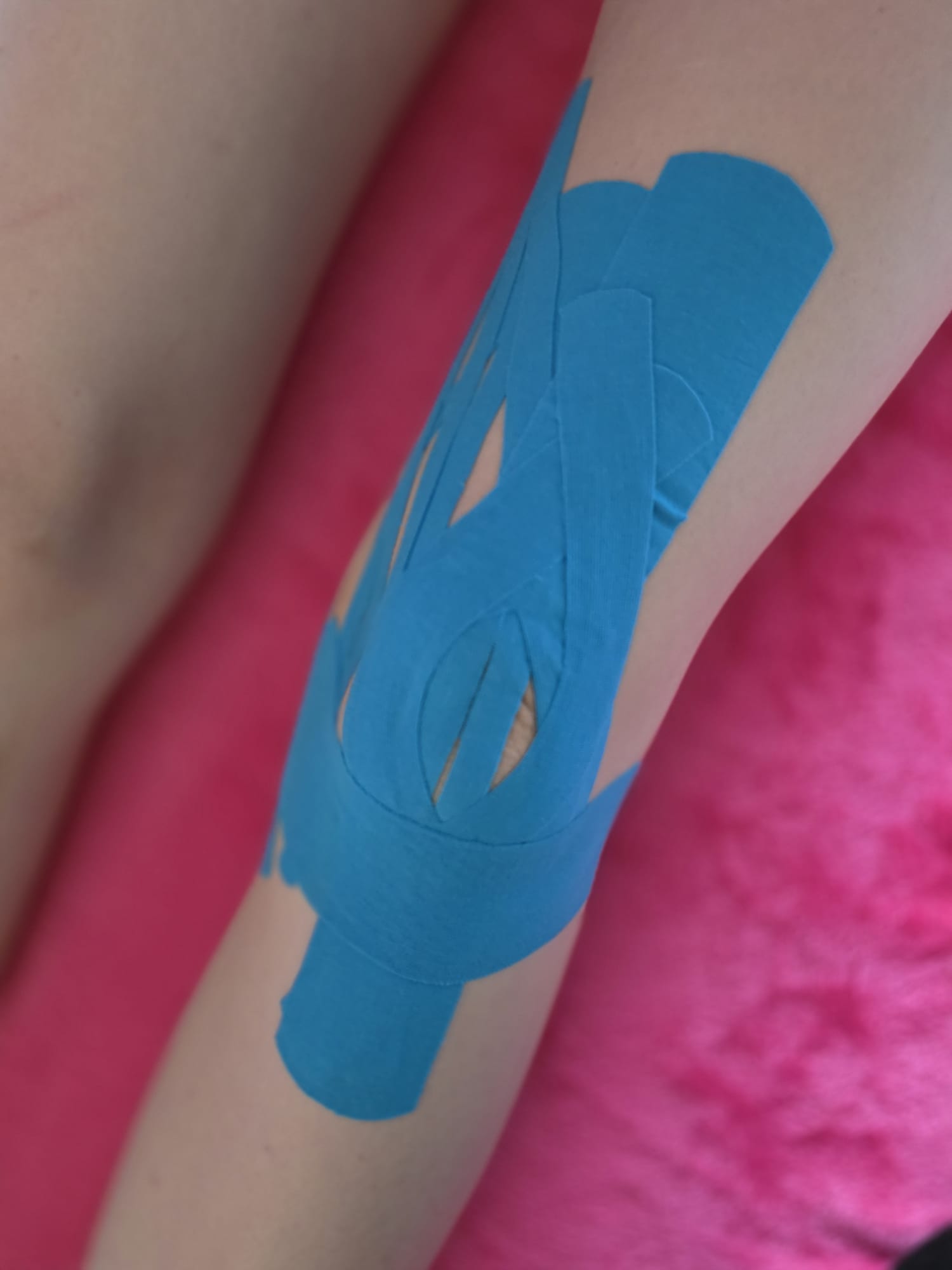 Kinesio-Taping Knie