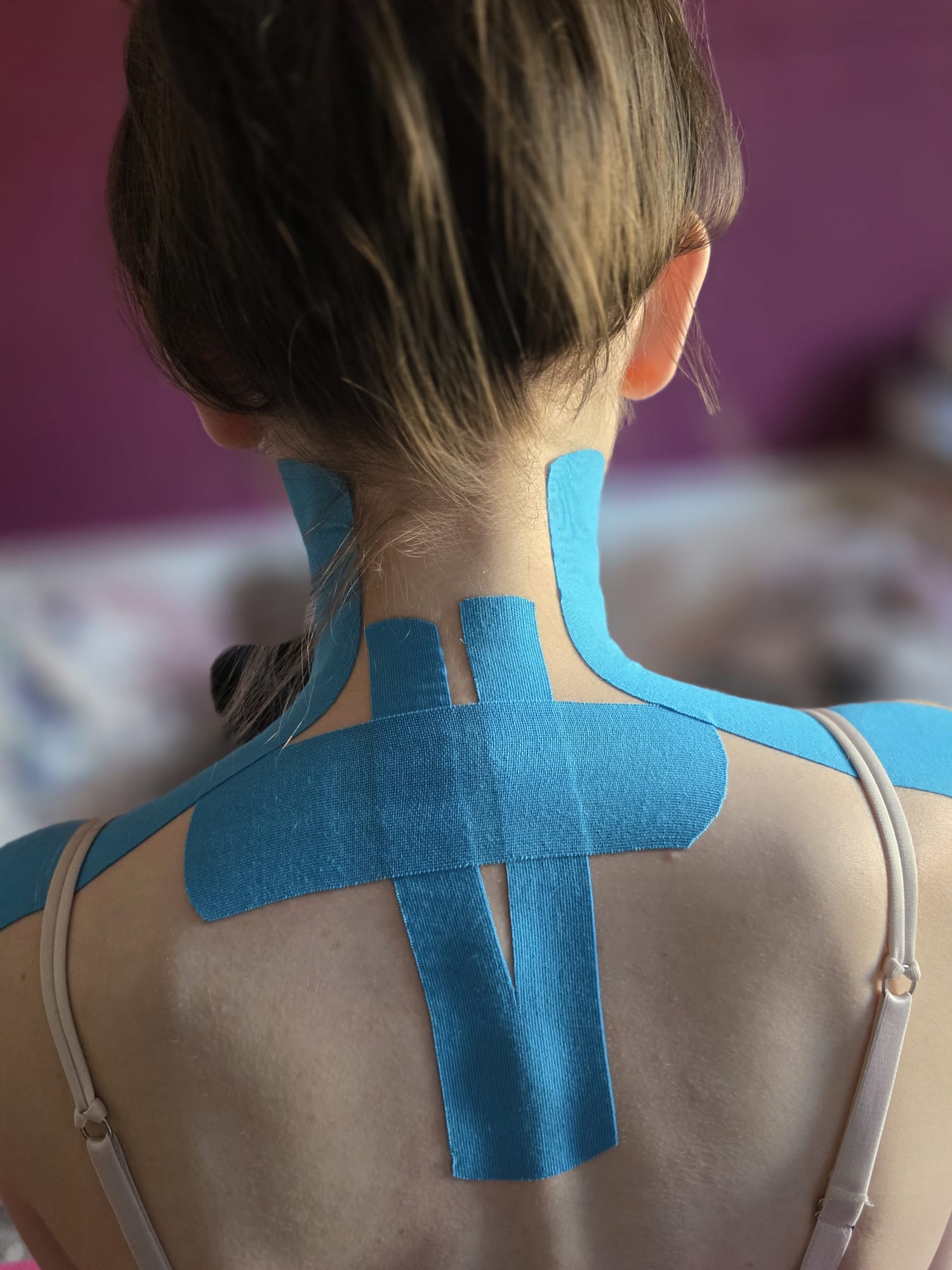 Kinesio-Taping Nacken